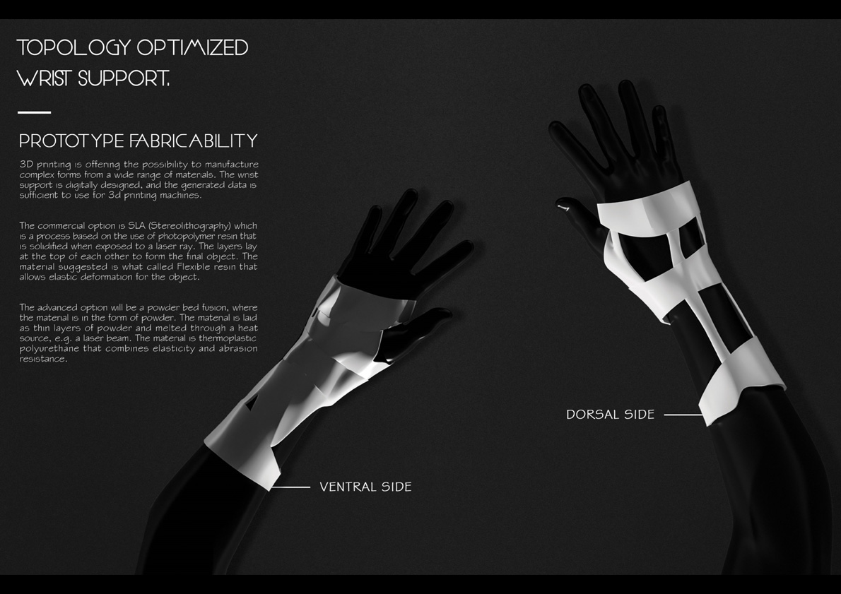 Topology Optimized Wrist Support