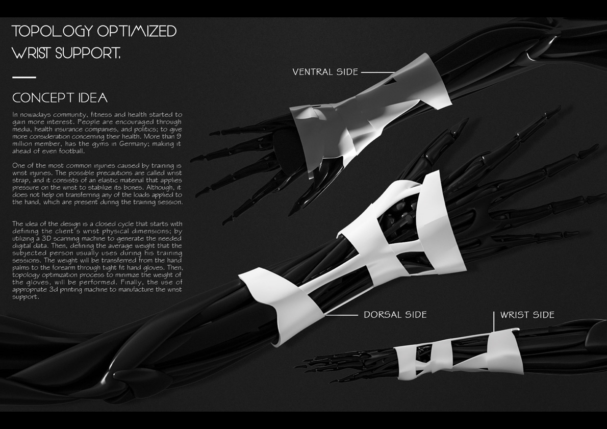 Topology Optimized Wrist Support 2