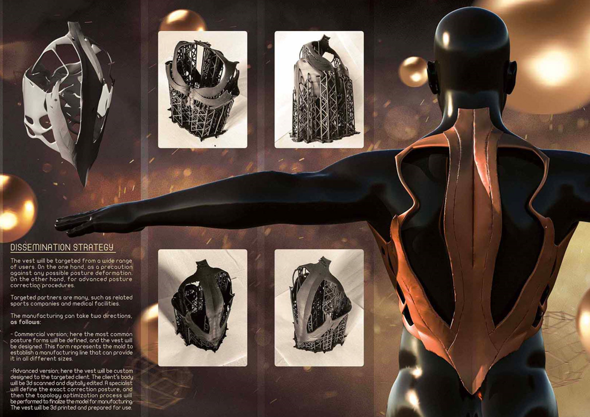 Topology Optimized Spinal and Posture Correction Structure 2